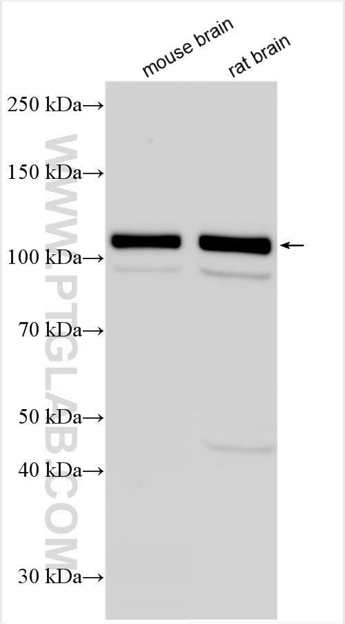 Western Blot (WB) analysis of various lysates using CASK Polyclonal antibody (55277-1-AP)