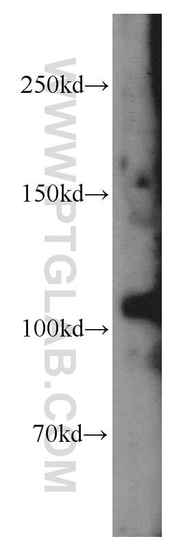 Western Blot (WB) analysis of mouse liver tissue using CASK Polyclonal antibody (55277-1-AP)