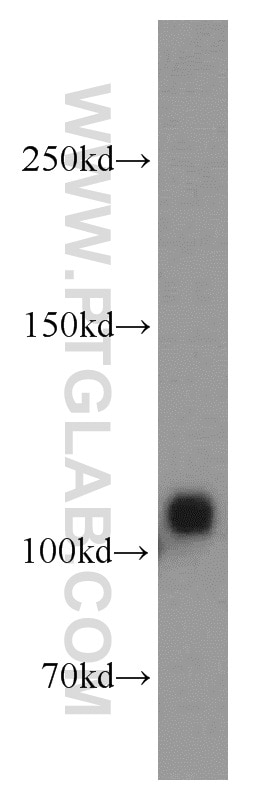 Western Blot (WB) analysis of mouse brain tissue using CASK Polyclonal antibody (55277-1-AP)