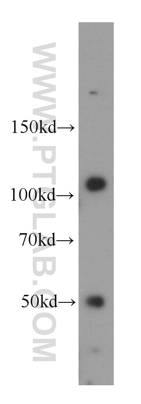 CASK Polyclonal antibody