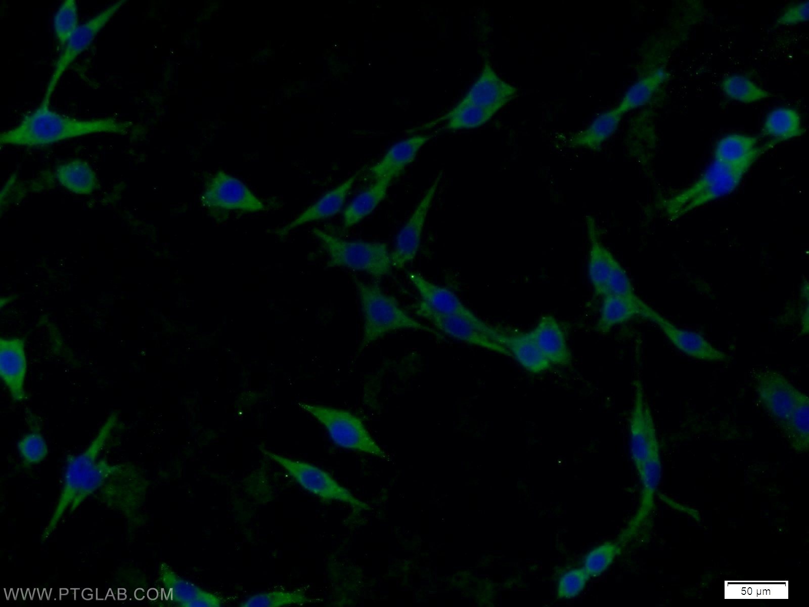 Immunofluorescence (IF) / fluorescent staining of C6 cells using Caspase 1/p20/p10 Polyclonal antibody (22915-1-AP)