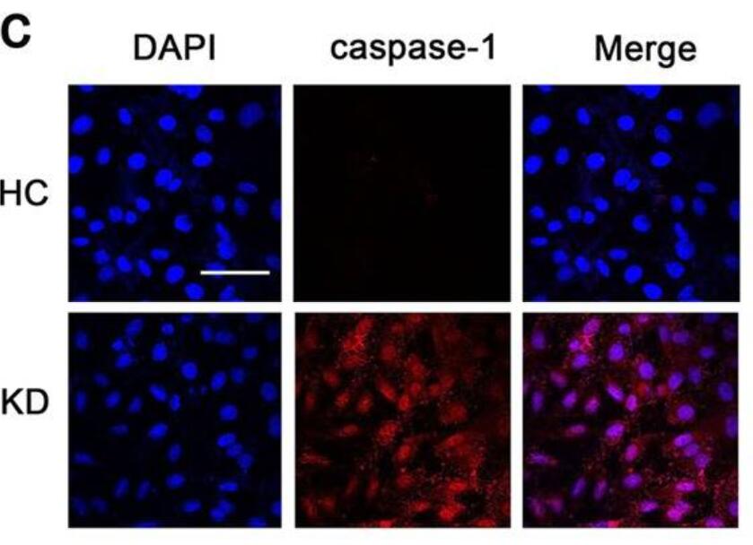 Immunofluorescence (IF) / fluorescent staining of HUVEC cells using Caspase 1/P20 Polyclonal antibody (22915-1-AP)
