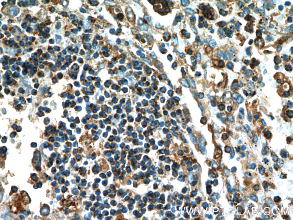 Immunohistochemistry (IHC) staining of human spleen tissue using Caspase 1/p20/p10 Polyclonal antibody (22915-1-AP)