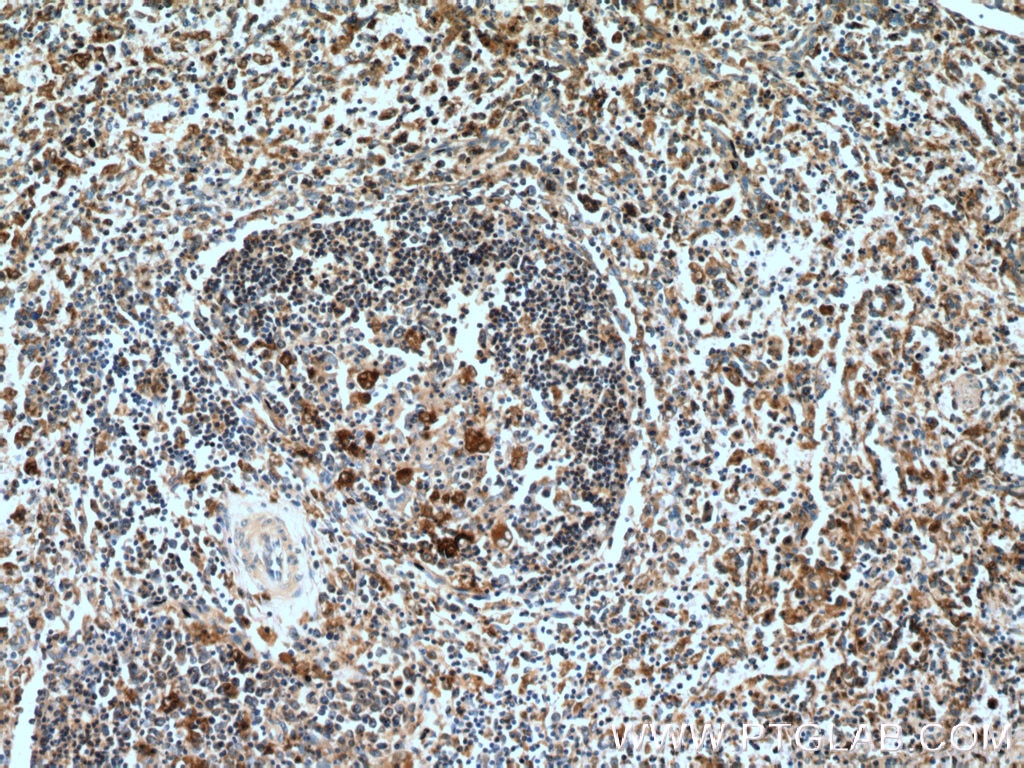 Immunohistochemistry (IHC) staining of human spleen tissue using Caspase 1/p20/p10 Polyclonal antibody (22915-1-AP)