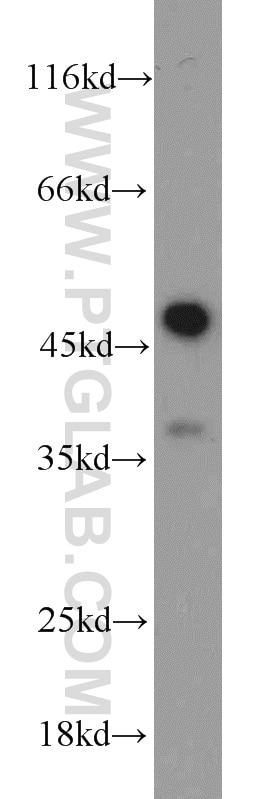 Western Blot (WB) analysis of Jurkat cells using Caspase 1/p20/p10 Polyclonal antibody (22915-1-AP)