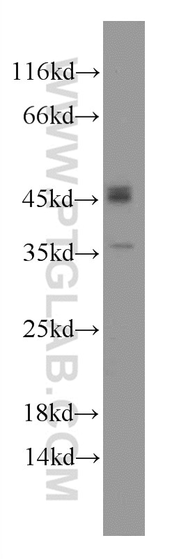 Western Blot (WB) analysis of Raji cells using Caspase 1/p20/p10 Polyclonal antibody (22915-1-AP)