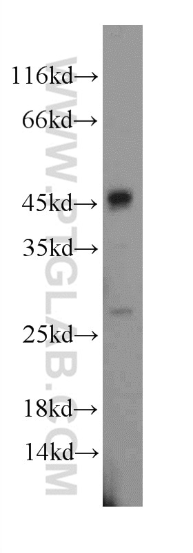 WB analysis of MCF-7 using 22915-1-AP