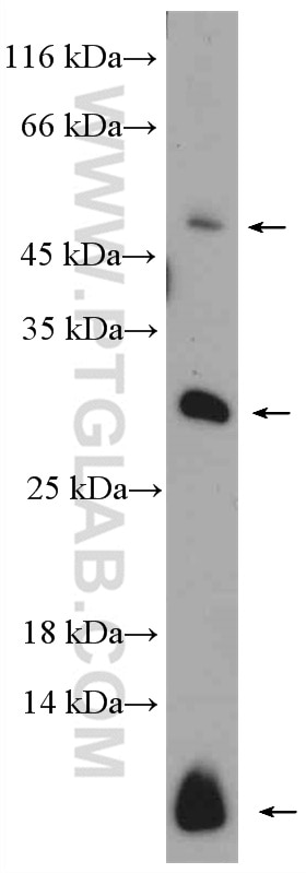 Western Blot (WB) analysis of Jurkat cells using Caspase 10/p23/17/p12 Polyclonal antibody (14311-1-AP)