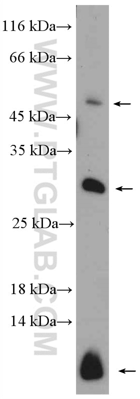 WB analysis of Jurkat using 14311-1-AP