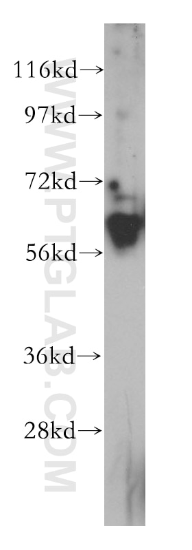 Western Blot (WB) analysis of HeLa cells using Caspase 10/p23/17/p12 Polyclonal antibody (14311-1-AP)