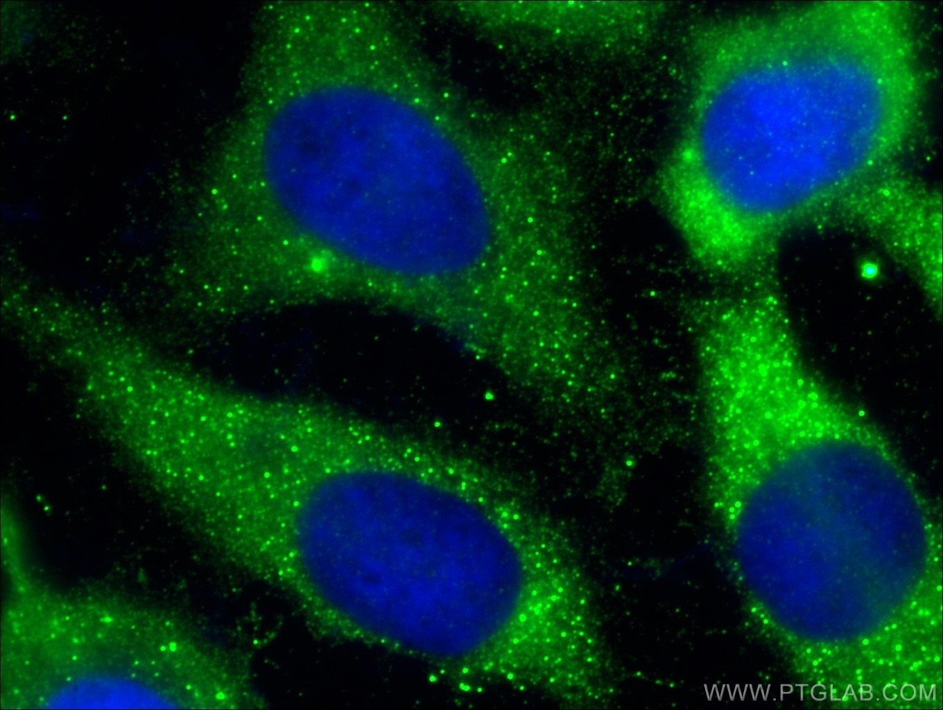 Immunofluorescence (IF) / fluorescent staining of HeLa cells using Caspase 12 Polyclonal antibody (55238-1-AP)