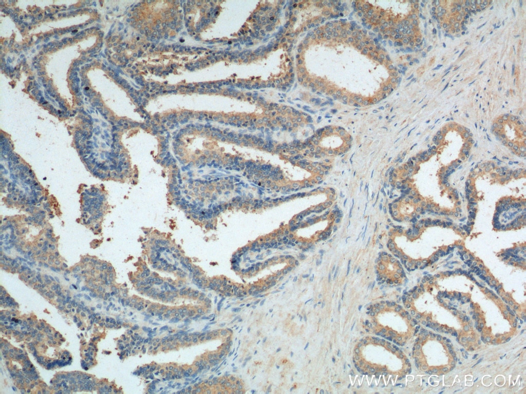 Immunohistochemistry (IHC) staining of human prostate hyperplasia tissue using Caspase 12 Polyclonal antibody (55238-1-AP)