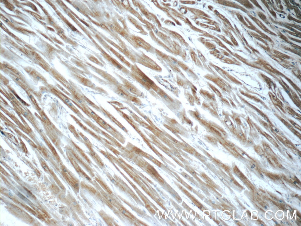 Immunohistochemistry (IHC) staining of human heart tissue using Caspase 12 Polyclonal antibody (55238-1-AP)