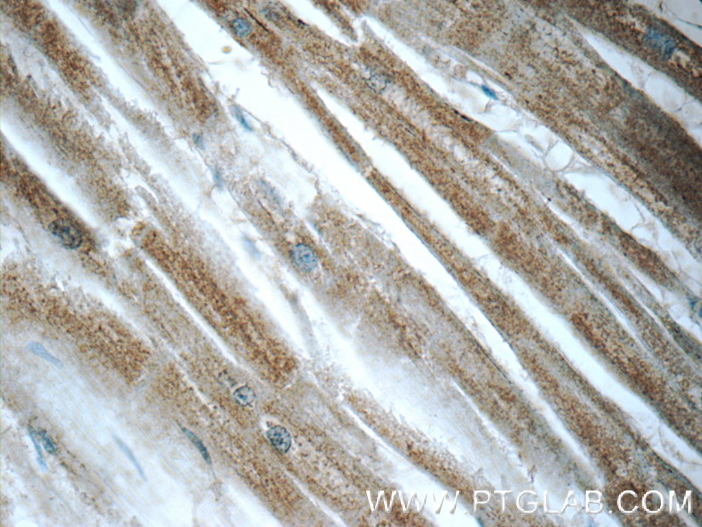 Immunohistochemistry (IHC) staining of human heart tissue using Caspase 12 Polyclonal antibody (55238-1-AP)