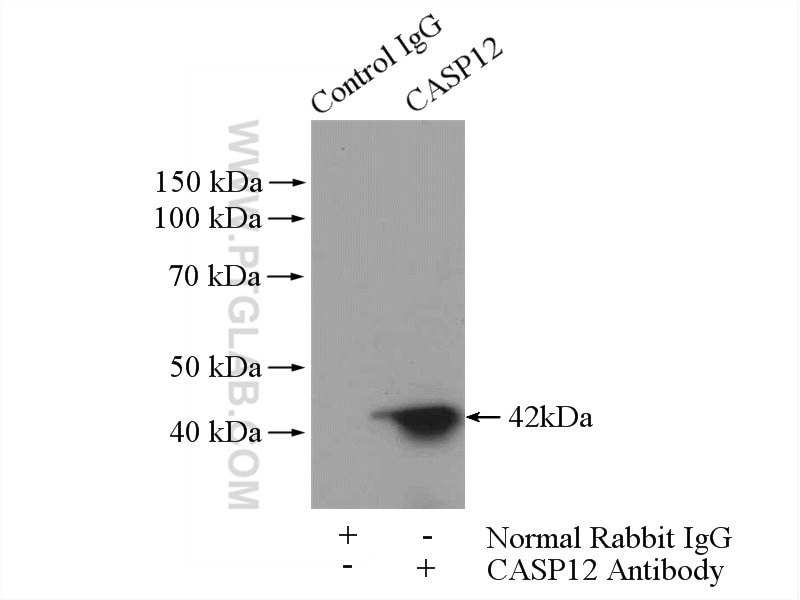 Immunoprecipitation (IP) experiment of HEK-293 cells using Caspase 12 Polyclonal antibody (55238-1-AP)