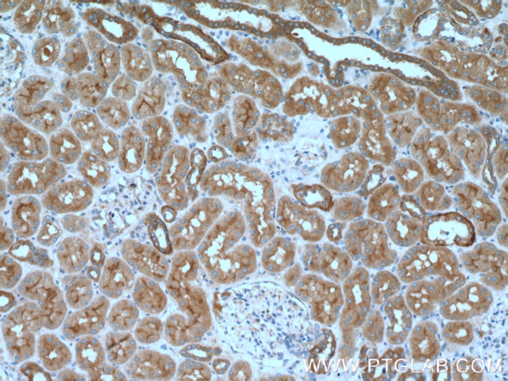 IHC staining of human kidney using 10436-1-AP