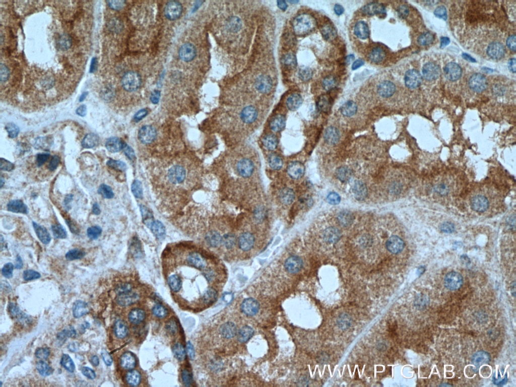 Immunohistochemistry (IHC) staining of human kidney tissue using Caspase 2/p32/p18 Polyclonal antibody (10436-1-AP)