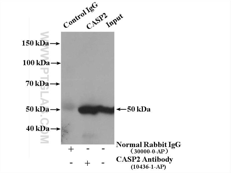 Immunoprecipitation (IP) experiment of HeLa cells using Caspase 2/p32/p18 Polyclonal antibody (10436-1-AP)