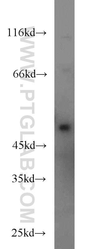 Western Blot (WB) analysis of HEK-293 cells using Caspase 2/p32/p18 Polyclonal antibody (10436-1-AP)