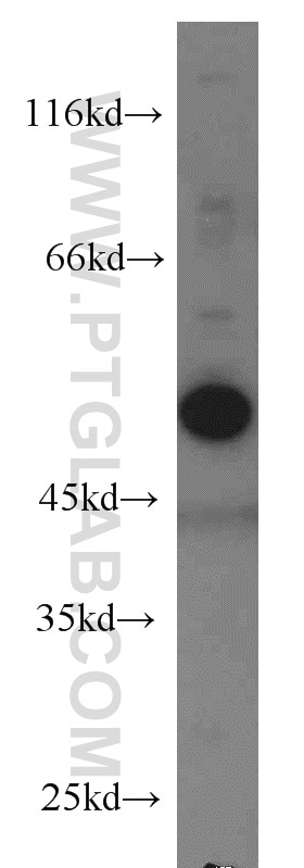 Western Blot (WB) analysis of Jurkat cells using Caspase 2/p32/p18 Polyclonal antibody (10436-1-AP)