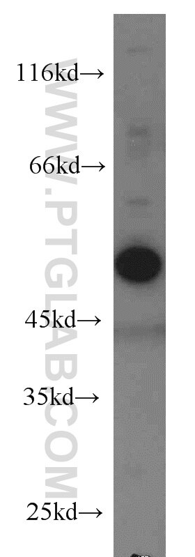 WB analysis of Jurkat using 10436-1-AP