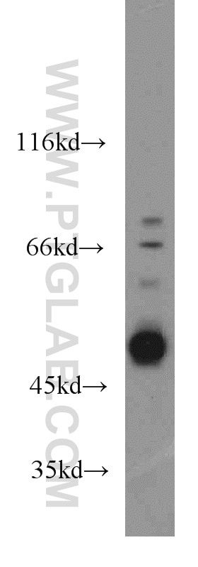 Western Blot (WB) analysis of HeLa cells using Caspase 2/p32/p18 Polyclonal antibody (10436-1-AP)