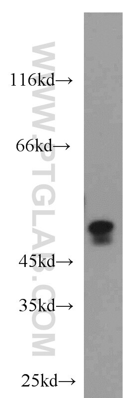 Western Blot (WB) analysis of mouse kidney tissue using Caspase 2/p32/p18 Polyclonal antibody (10436-1-AP)