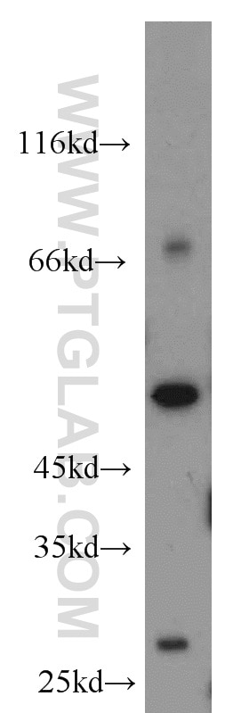 Western Blot (WB) analysis of HL-60 cells using Caspase 2/p32/p18 Polyclonal antibody (10436-1-AP)