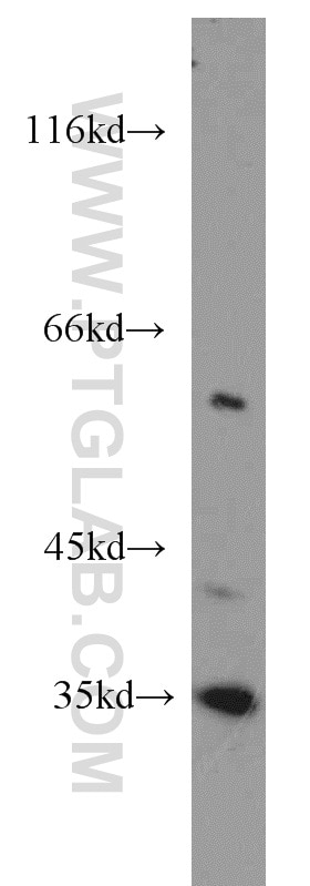 Western Blot (WB) analysis of mouse liver tissue using Caspase 2/p32/p18 Polyclonal antibody (10436-1-AP)