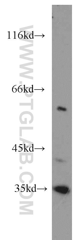 WB analysis of mouse liver using 10436-1-AP