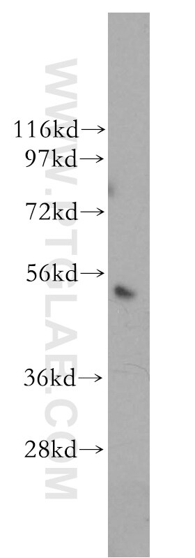 Western Blot (WB) analysis of HEK-293 cells using Caspase 2/p32/p18 Polyclonal antibody (10436-1-AP)