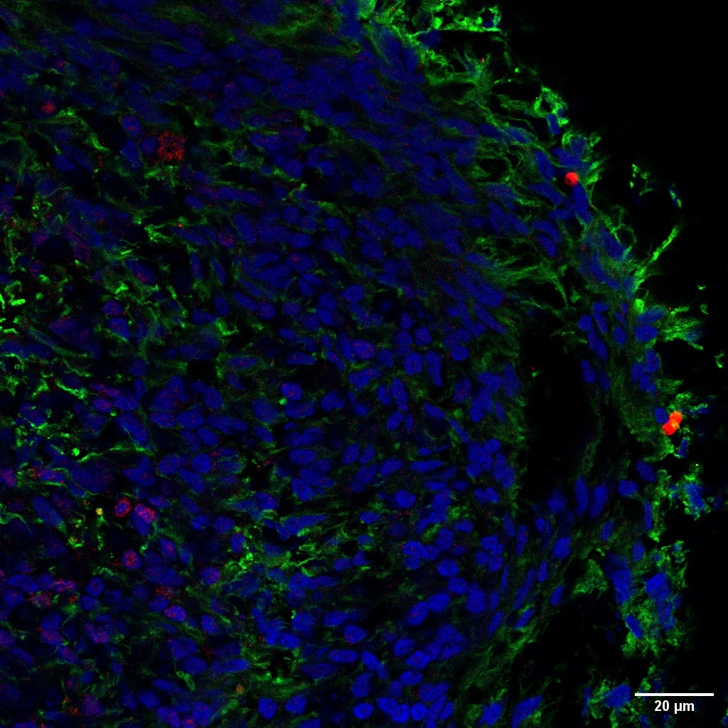 Immunofluorescence (IF) / fluorescent staining of Retinal organoids using Caspase 3/p17/p19 Polyclonal antibody (19677-1-AP)