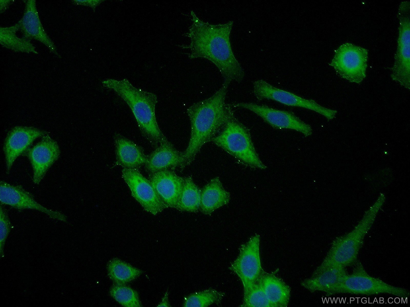 Caspase 3/p17/p19