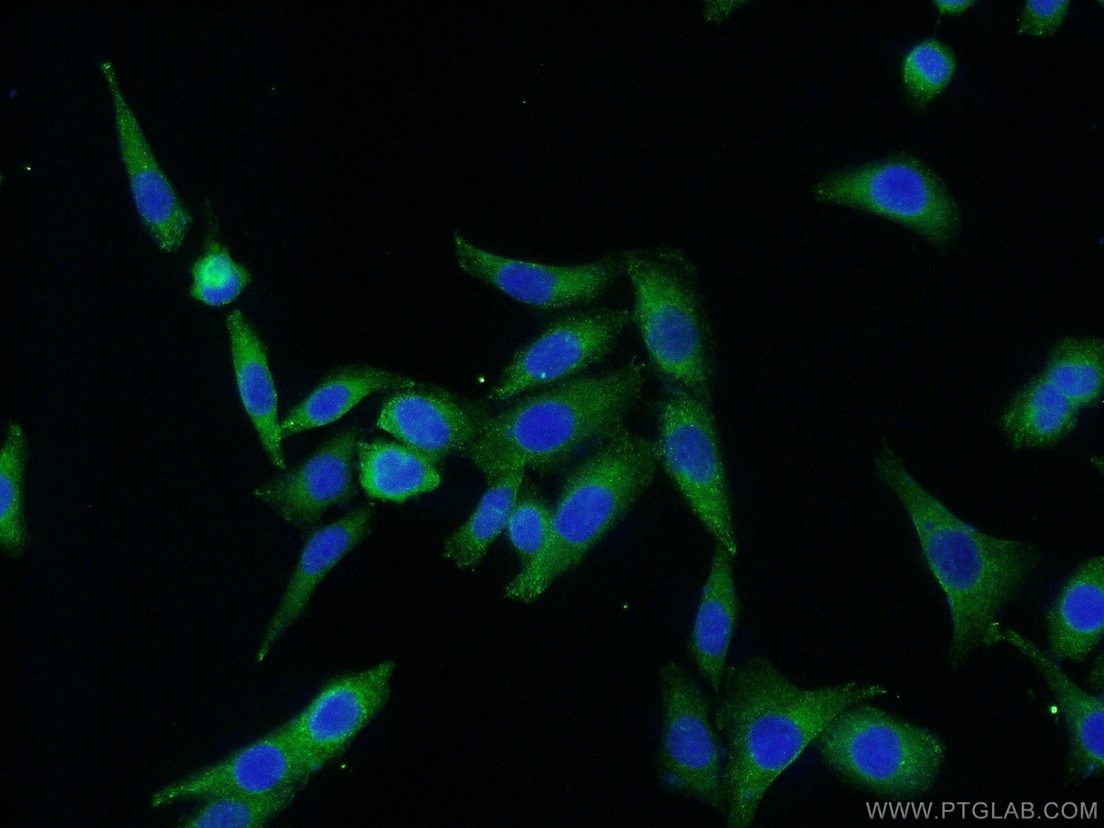 Immunofluorescence (IF) / fluorescent staining of HeLa cells using Caspase 3/p17/p19 Polyclonal antibody (19677-1-AP)