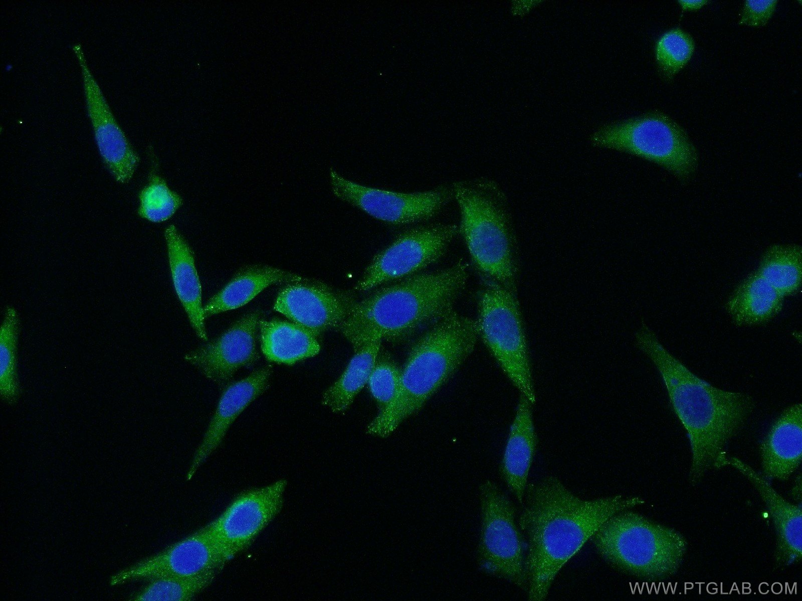 IF Staining of HeLa using 19677-1-AP