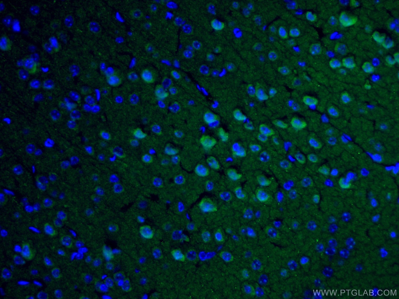 IF Staining of mouse brain using 19677-1-AP