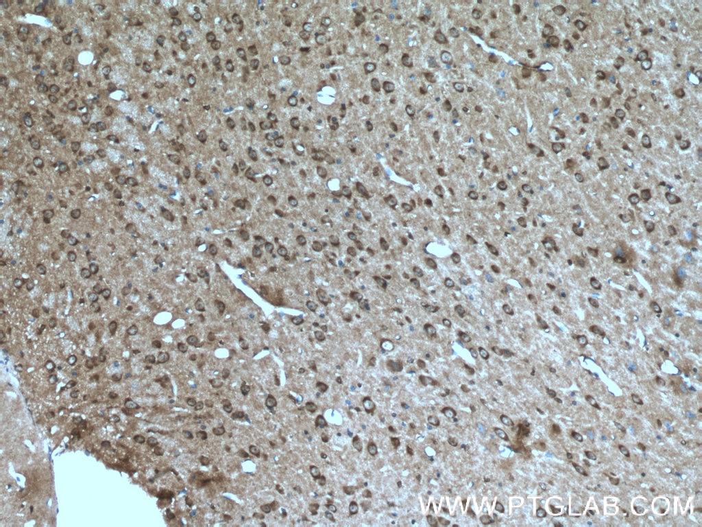 Immunohistochemistry (IHC) staining of mouse brain tissue using Caspase 3/p17/p19 Polyclonal antibody (19677-1-AP)