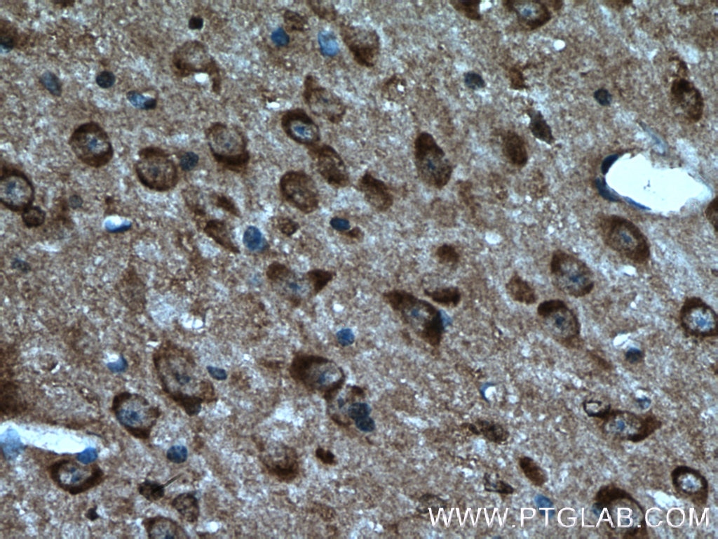 Immunohistochemistry (IHC) staining of mouse brain tissue using Caspase 3/p17/p19 Polyclonal antibody (19677-1-AP)