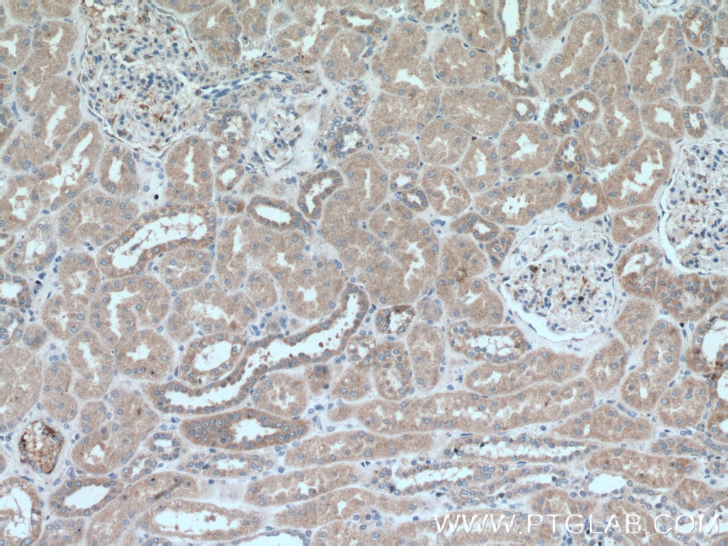 Immunohistochemistry (IHC) staining of human kidney tissue using Caspase 3/p17/p19 Polyclonal antibody (19677-1-AP)