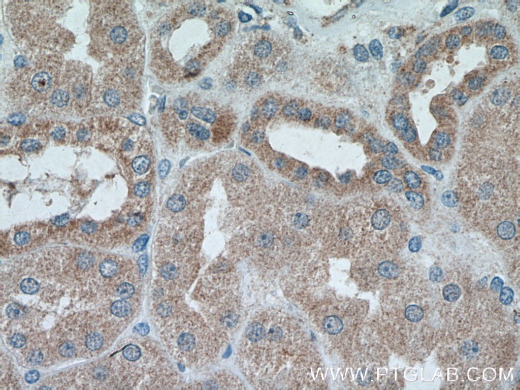 Immunohistochemistry (IHC) staining of human kidney tissue using Caspase 3/p17/p19 Polyclonal antibody (19677-1-AP)