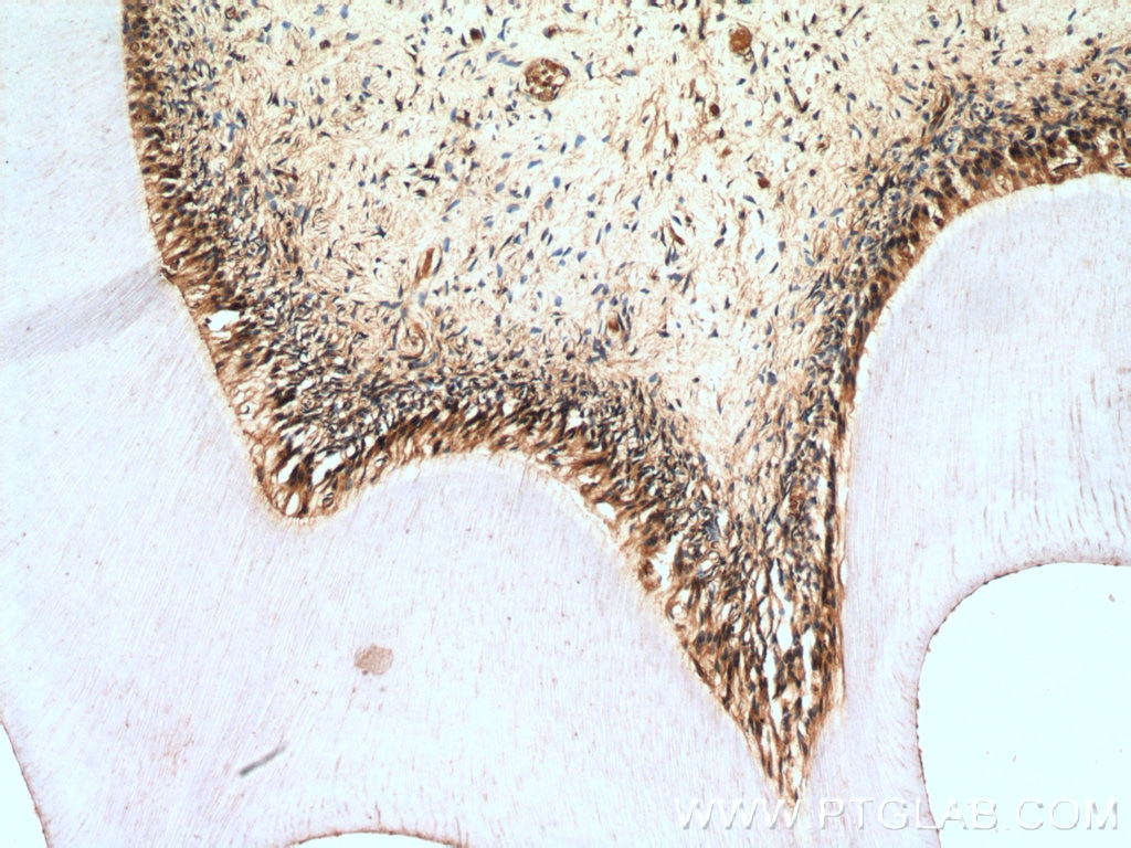 Immunohistochemistry (IHC) staining of human teeth tissue using Caspase 3/p17/p19 Polyclonal antibody (19677-1-AP)