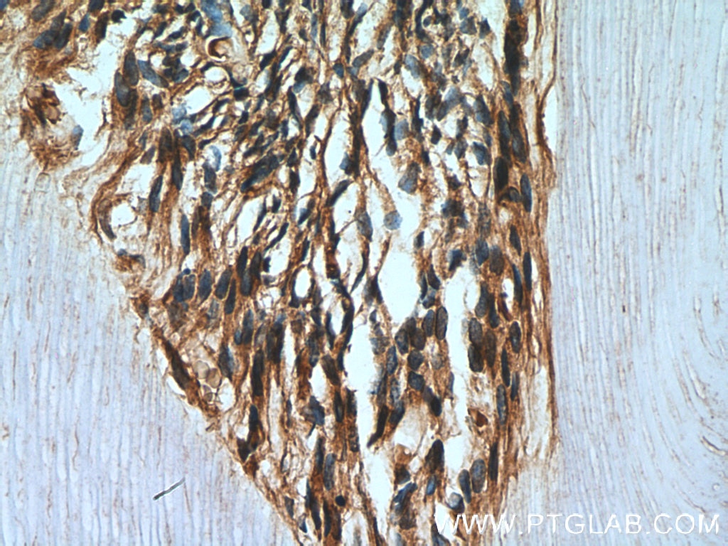 Immunohistochemistry (IHC) staining of human teeth tissue using Caspase 3/p17/p19 Polyclonal antibody (19677-1-AP)