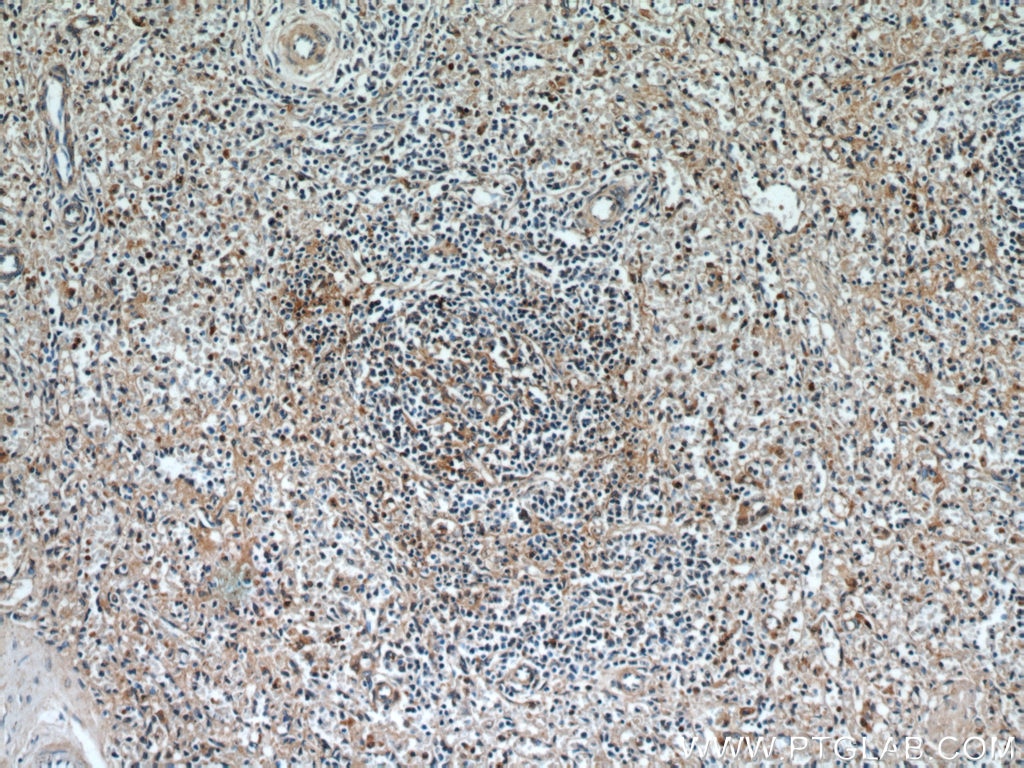 IHC staining of human spleen using 19677-1-AP