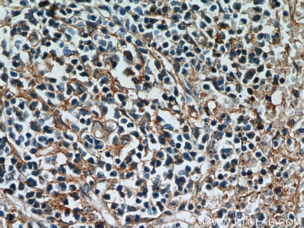 Immunohistochemistry (IHC) staining of human spleen tissue using Caspase 3/p17/p19 Polyclonal antibody (19677-1-AP)