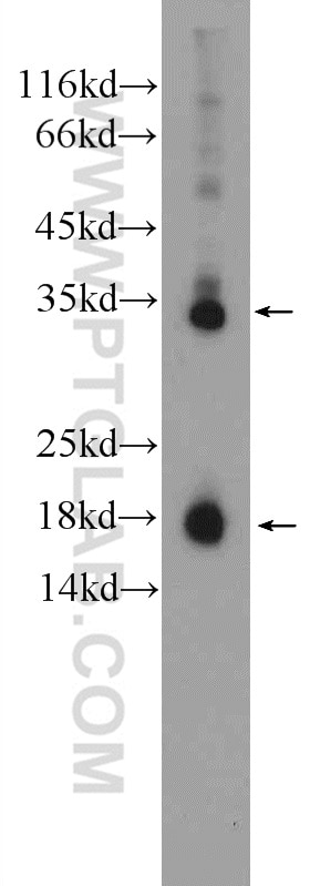 Western Blot (WB) analysis of Jurkat cells using Caspase 3/p17/p19 Polyclonal antibody (19677-1-AP)