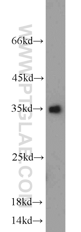 Western Blot (WB) analysis of HeLa cells using Caspase 3/p17/p19 Polyclonal antibody (19677-1-AP)
