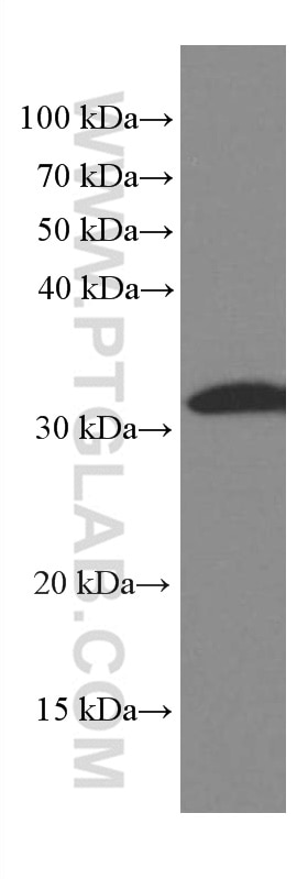 WB analysis of HEK-293 using 66470-1-Ig
