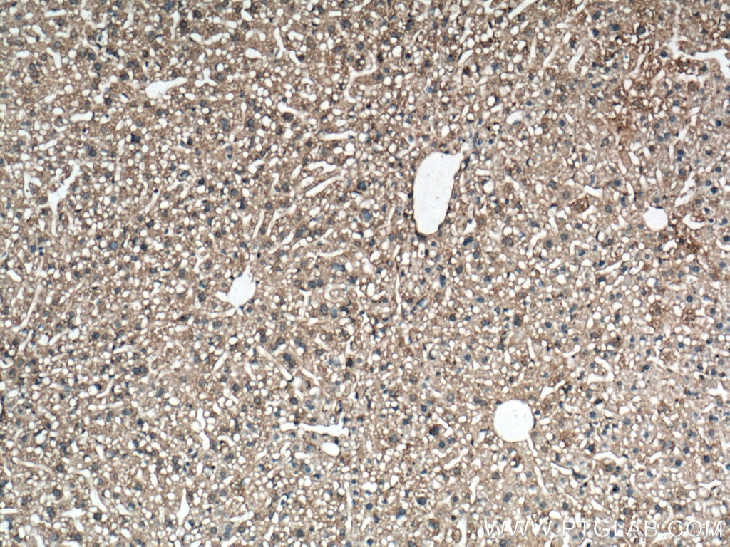 IHC staining of mouse liver using 66470-2-Ig