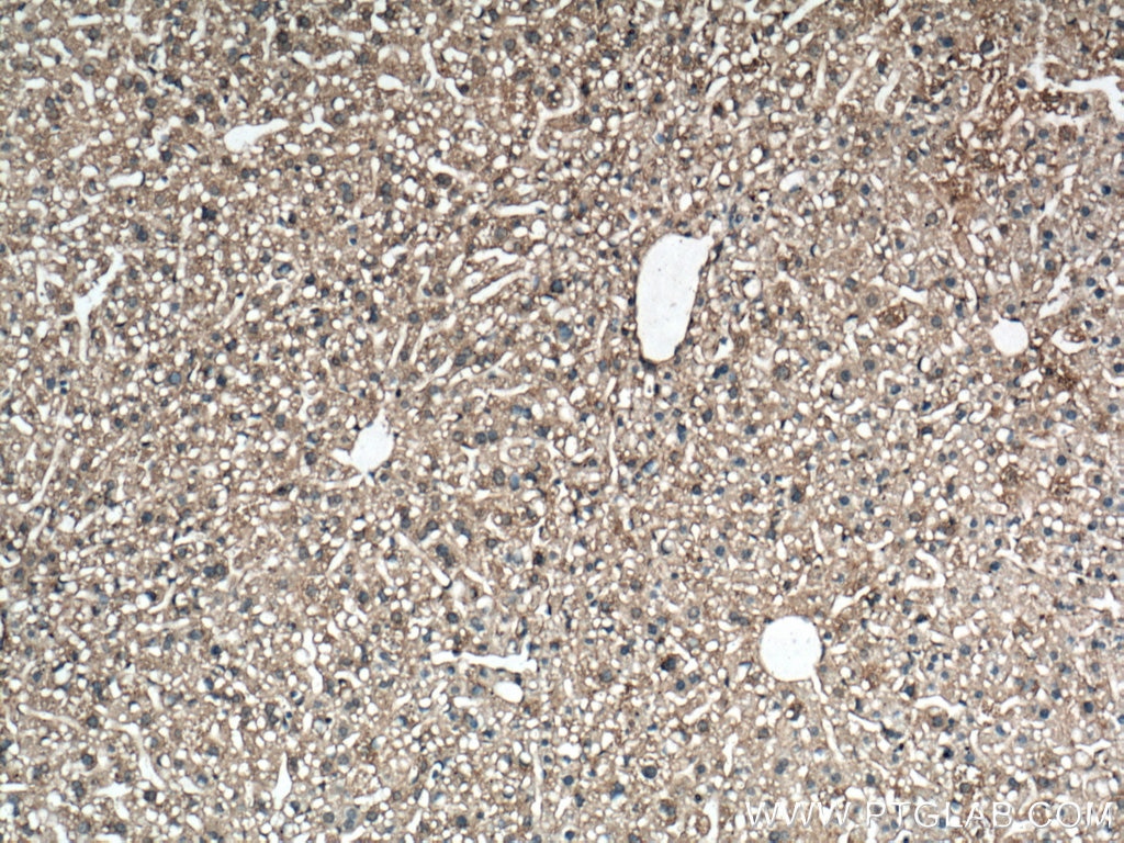 Immunohistochemistry (IHC) staining of mouse liver tissue using Caspase 3/p17/p19 Monoclonal antibody (66470-2-Ig)