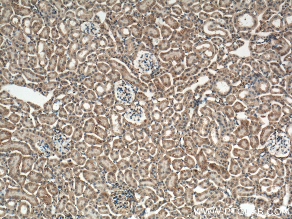 Immunohistochemistry (IHC) staining of mouse kidney tissue using Caspase 3/p17/p19 Monoclonal antibody (66470-2-Ig)